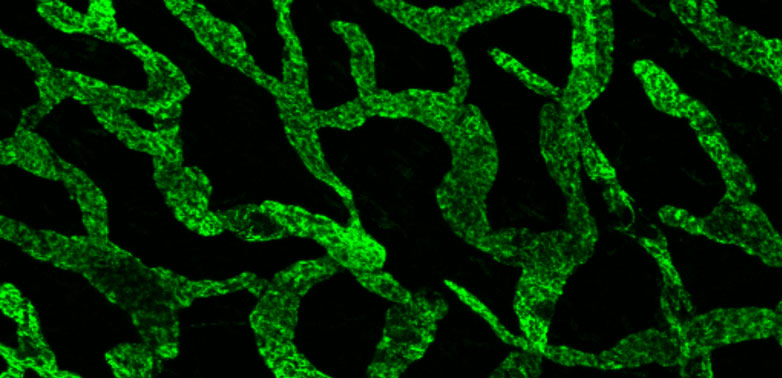 Enlarged view: Inflammatory response