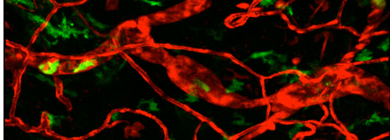 Enlarged view: Leukocyte migration