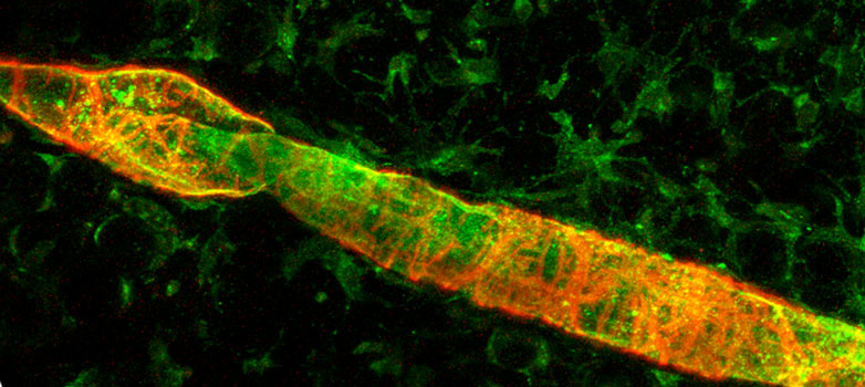 Enlarged view: Lymphatic function 